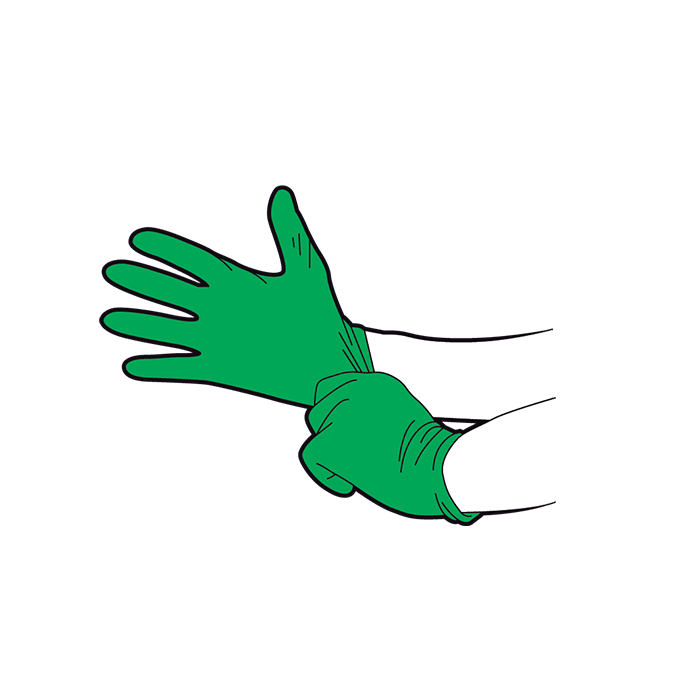 Chemical burns first aid - wear protective gloves