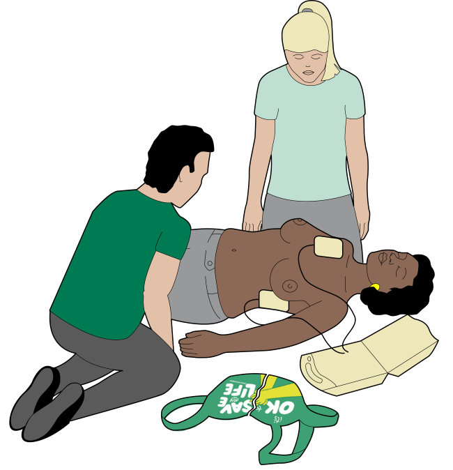 Illustration showing bystanders placing defibrillator pads on the chest