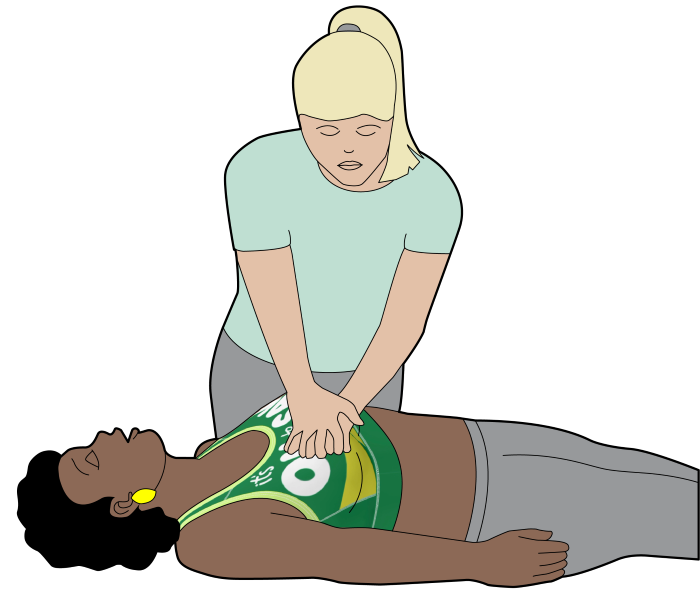 Illustration of woman receiving chest compressions