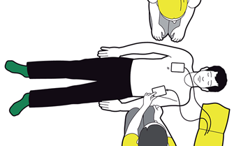Using a defibrillator - attach pads Using a defibrillator - attach pads
