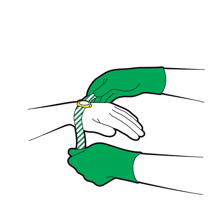 Adult minor burns and scalds - remove jewellery or clothing