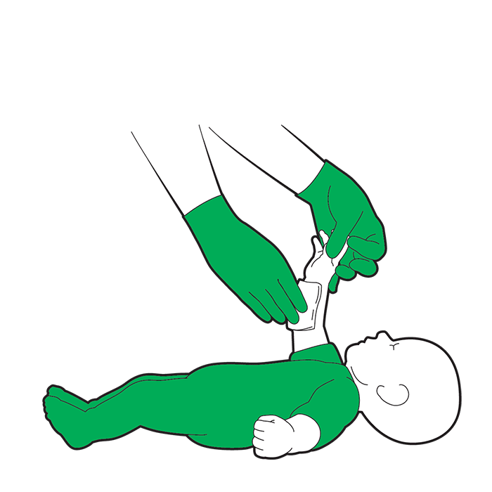 Baby Bleeding - Paediatric & Baby First Aid | St John Ambulance