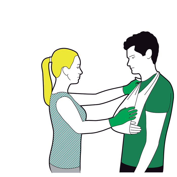 Severe bleeding first aid - support the injured part and check circulation every 10 minutes